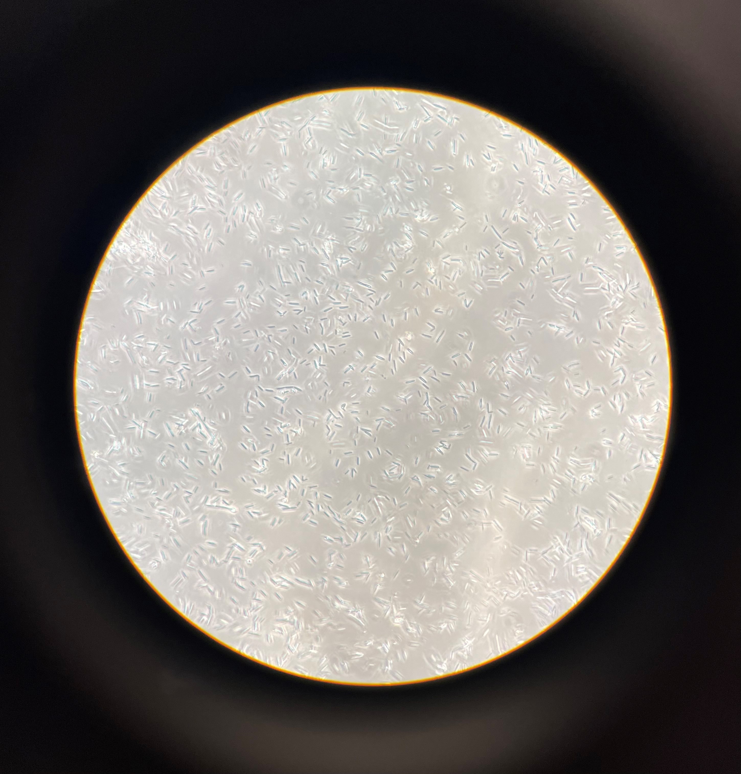 Colony of butanol-producing bacteria (Clostridium beijerinckii)